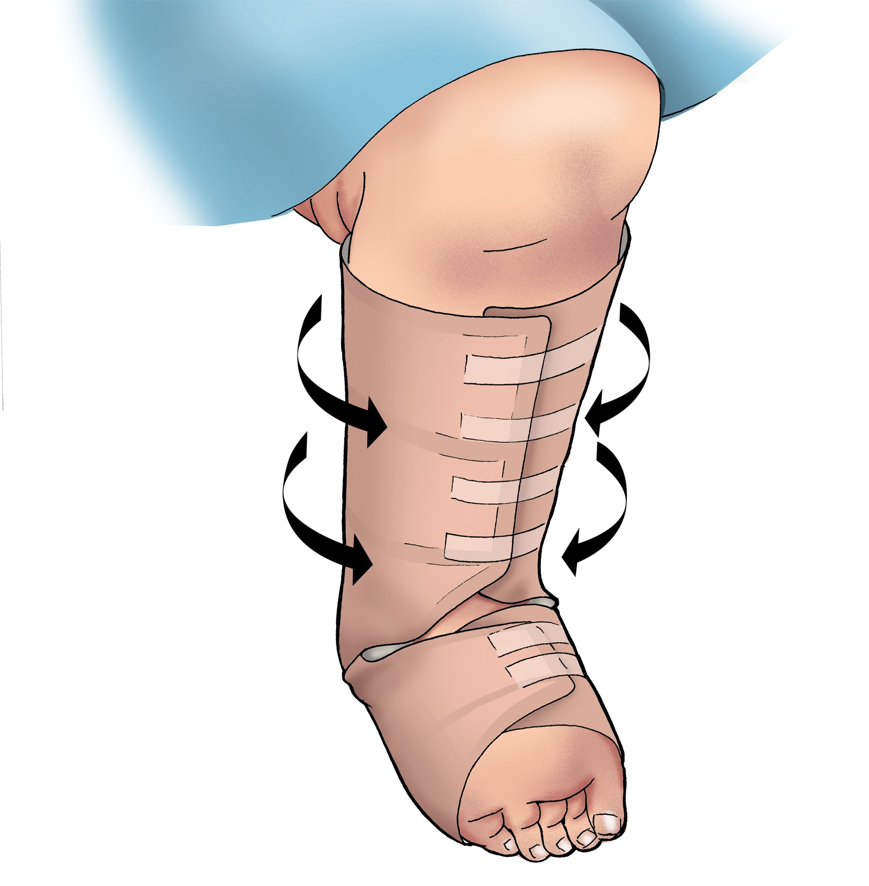 Eclypse Boot Super Absorbent Dressing